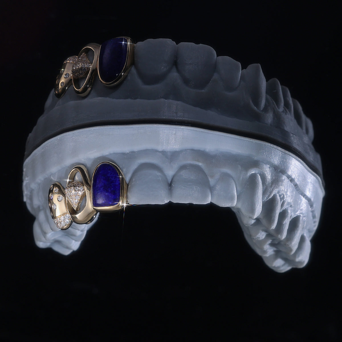 Q. Jones Custom grillz worn close-up